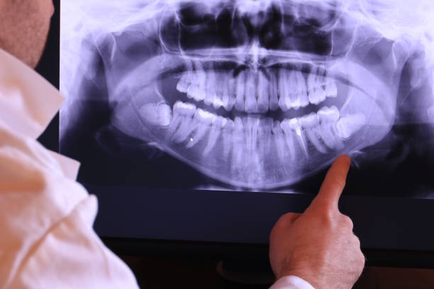 Best Broken or Chipped Tooth Repair in Ingram, TX